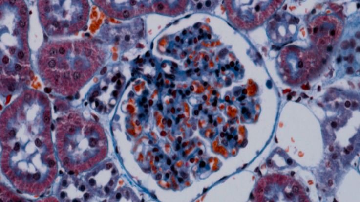 Glomerular Filtration